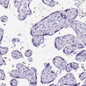Anti-PPP1R17 antibody produced in rabbit Prestige Antibodies® Powered by Atlas Antibodies, affinity isolated antibody, buffered aqueous glycerol solution