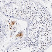 Anti-HORMAD2 antibody produced in rabbit Prestige Antibodies® Powered by Atlas Antibodies, affinity isolated antibody, buffered aqueous glycerol solution