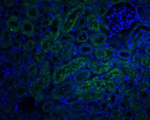 Anti-DCR2 antibody produced in rabbit affinity isolated antibody, buffered aqueous solution