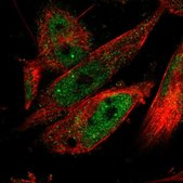 Anti-CPSF2 antibody produced in rabbit Prestige Antibodies® Powered by Atlas Antibodies, affinity isolated antibody, buffered aqueous glycerol solution