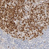 Anti-MEF2B antibody produced in rabbit Prestige Antibodies® Powered by Atlas Antibodies, affinity isolated antibody, buffered aqueous glycerol solution