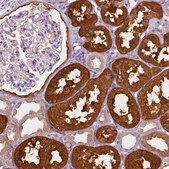 Anti-SHMT1 antibody produced in rabbit Prestige Antibodies® Powered by Atlas Antibodies, affinity isolated antibody, buffered aqueous glycerol solution