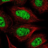 Anti-BPNT1 antibody produced in rabbit Prestige Antibodies® Powered by Atlas Antibodies, affinity isolated antibody, buffered aqueous glycerol solution