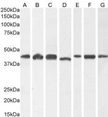 Anti-CCM2 antibody produced in goat affinity isolated antibody, buffered aqueous solution