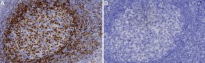 Anti-PAX5 Antibody, clone 1B14 ZooMAb® Rabbit Monoclonal recombinant, expressed in HEK 293 cells