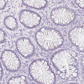 Anti-KLK8 antibody produced in rabbit Prestige Antibodies® Powered by Atlas Antibodies, affinity isolated antibody, buffered aqueous glycerol solution
