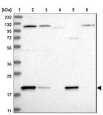 Anti-ADI1 antibody produced in rabbit Prestige Antibodies® Powered by Atlas Antibodies, affinity isolated antibody, buffered aqueous glycerol solution