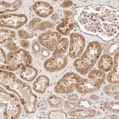 Anti-TIMM17A antibody produced in rabbit Prestige Antibodies® Powered by Atlas Antibodies, affinity isolated antibody, buffered aqueous glycerol solution
