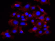 MOC1 Mouse Oral Squamous Cell Carcinoma (OSCC) Cell Line