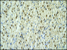 Anti-ANP32A (AB1) antibody produced in rabbit affinity isolated antibody