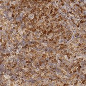Anti-APOBEC3G antibody produced in rabbit Prestige Antibodies® Powered by Atlas Antibodies, affinity isolated antibody, buffered aqueous glycerol solution