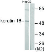 Anti-Keratin 16 antibody produced in rabbit affinity isolated antibody