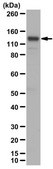 Anti-TACC3 Antibody from rabbit, purified by affinity chromatography