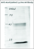 Anti-Acetylated Lysine antibody produced in rabbit 1 mg/mL, affinity isolated antibody