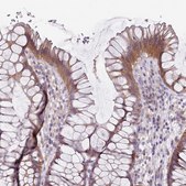 Anti-SLC26A6 antibody produced in rabbit Prestige Antibodies® Powered by Atlas Antibodies, affinity isolated antibody, buffered aqueous glycerol solution