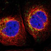 Anti-MRPL10 antibody produced in rabbit Prestige Antibodies® Powered by Atlas Antibodies, affinity isolated antibody, buffered aqueous glycerol solution