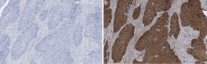 Anti-Integrin β1 Antibody, clone 1A27 , ZooMAb® Rabbit Monoclonal recombinant, expressed in HEK 293 cells