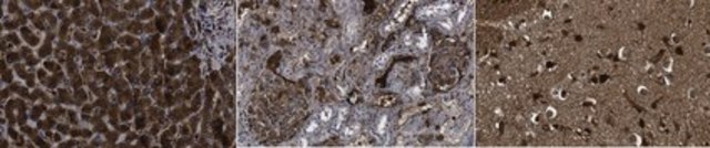 Anti-C-Reactive Protein Antibody, clone 2A8.1 clone 2A8.1, from mouse