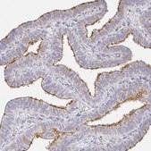 Anti-TJP3 antibody produced in rabbit Prestige Antibodies® Powered by Atlas Antibodies, affinity isolated antibody, buffered aqueous glycerol solution