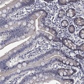 Anti-PHKA1 antibody produced in rabbit Prestige Antibodies® Powered by Atlas Antibodies, affinity isolated antibody, buffered aqueous glycerol solution