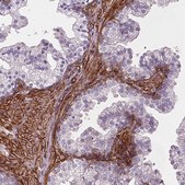 Anti-EGFL8 antibody produced in rabbit Prestige Antibodies® Powered by Atlas Antibodies, affinity isolated antibody, buffered aqueous glycerol solution
