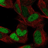 Anti-ESRRG antibody produced in rabbit Prestige Antibodies® Powered by Atlas Antibodies, affinity isolated antibody, buffered aqueous glycerol solution