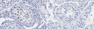 Anti-p14ARF Antibody, clone 4F19 ZooMAb® Rabbit Monoclonal recombinant, expressed in HEK 293 cells