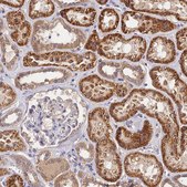 Anti-RANBP6 antibody produced in rabbit Prestige Antibodies® Powered by Atlas Antibodies, affinity isolated antibody, buffered aqueous glycerol solution