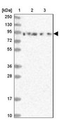 Anti-DDX51 antibody produced in rabbit Prestige Antibodies® Powered by Atlas Antibodies, affinity isolated antibody, buffered aqueous glycerol solution
