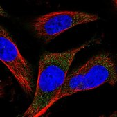 Anti-MARCH3 antibody produced in rabbit Prestige Antibodies® Powered by Atlas Antibodies, affinity isolated antibody, buffered aqueous glycerol solution