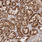 Anti-MRPS10 antibody produced in rabbit Prestige Antibodies® Powered by Atlas Antibodies, affinity isolated antibody, buffered aqueous glycerol solution, ab2