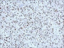 Anti-POM121 antibody produced in rabbit affinity isolated antibody, buffered aqueous solution