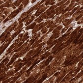 Anti-CSRP3 antibody produced in rabbit Prestige Antibodies® Powered by Atlas Antibodies, affinity isolated antibody, buffered aqueous glycerol solution