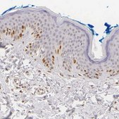 Anti-MKI67 antibody produced in rabbit Ab1, Prestige Antibodies® Powered by Atlas Antibodies, affinity isolated antibody, buffered aqueous glycerol solution