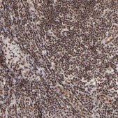 Anti-GABPA antibody produced in rabbit Prestige Antibodies® Powered by Atlas Antibodies, affinity isolated antibody, buffered aqueous glycerol solution