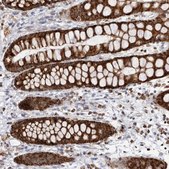 Anti-COX5A antibody produced in rabbit Prestige Antibodies® Powered by Atlas Antibodies, affinity isolated antibody, buffered aqueous glycerol solution