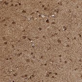 Anti-PHGDH antibody produced in rabbit Prestige Antibodies® Powered by Atlas Antibodies, affinity isolated antibody, buffered aqueous glycerol solution, Ab1