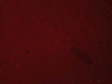 Autofluorescence Eliminator Reagent Autofluorescence Eliminator Reagent for IHC.