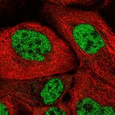 Anti-SRSF7 antibody produced in rabbit Prestige Antibodies® Powered by Atlas Antibodies, affinity isolated antibody, buffered aqueous glycerol solution