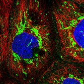 Anti-RNF138 antibody produced in rabbit Prestige Antibodies® Powered by Atlas Antibodies, affinity isolated antibody, buffered aqueous glycerol solution