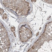 Anti-GRSF1 antibody produced in rabbit Prestige Antibodies® Powered by Atlas Antibodies, affinity isolated antibody, buffered aqueous glycerol solution