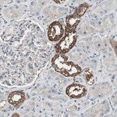 Anti-HPRT1 antibody produced in rabbit Prestige Antibodies® Powered by Atlas Antibodies, affinity isolated antibody, buffered aqueous glycerol solution