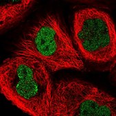 Anti-ATG16L2 antibody produced in rabbit Prestige Antibodies® Powered by Atlas Antibodies, affinity isolated antibody, buffered aqueous glycerol solution