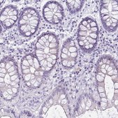 Anti-RYR1 antibody produced in rabbit Prestige Antibodies® Powered by Atlas Antibodies, affinity isolated antibody, buffered aqueous glycerol solution
