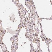 Anti-XAGE2 antibody produced in rabbit Prestige Antibodies® Powered by Atlas Antibodies, affinity isolated antibody, buffered aqueous glycerol solution