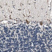 Anti-EIF2B2 antibody produced in rabbit Prestige Antibodies® Powered by Atlas Antibodies, affinity isolated antibody, buffered aqueous glycerol solution