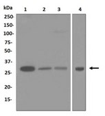 Anti-PSMA7, clone EPR5836, Rabbit Monoclonal Antibody clone EPR5836, from rabbit