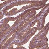 Anti-CNOT2 antibody produced in rabbit Prestige Antibodies® Powered by Atlas Antibodies, affinity isolated antibody