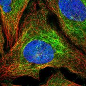 Anti-SLC1A6 antibody produced in rabbit Prestige Antibodies® Powered by Atlas Antibodies, affinity isolated antibody, buffered aqueous glycerol solution