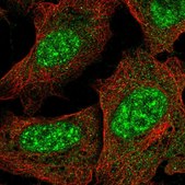 Anti-KCTD16 antibody produced in rabbit Prestige Antibodies® Powered by Atlas Antibodies, affinity isolated antibody, buffered aqueous glycerol solution